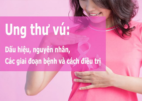 Điều trị ung thư vú