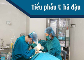 Tiểu phẫu u bã đậu