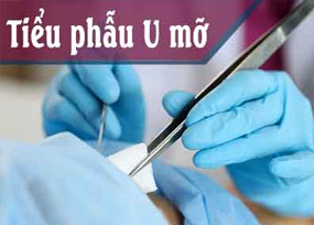 Tiểu phẫu u mỡ